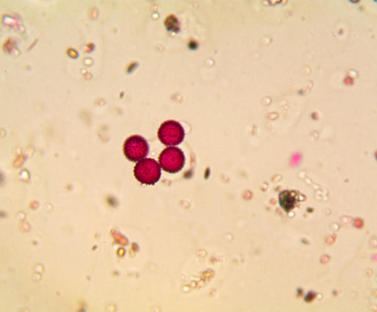 Photo d'une vue au mircoscope de 2 grains de pollen d'ambroisie, colorés en rose