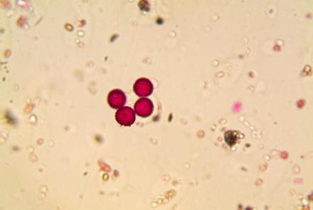 Photo d'une vue au mircoscope de 2 grains de pollen d'ambroisie, colorés en rose