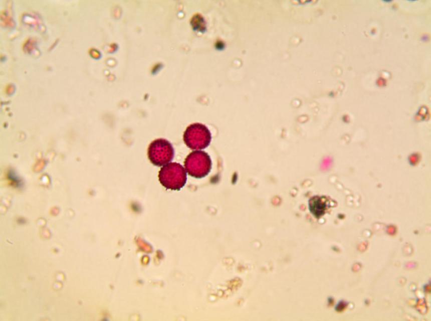 Photo d'une vue au mircoscope de 2 grains de pollen d'ambroisie, colorés en rose